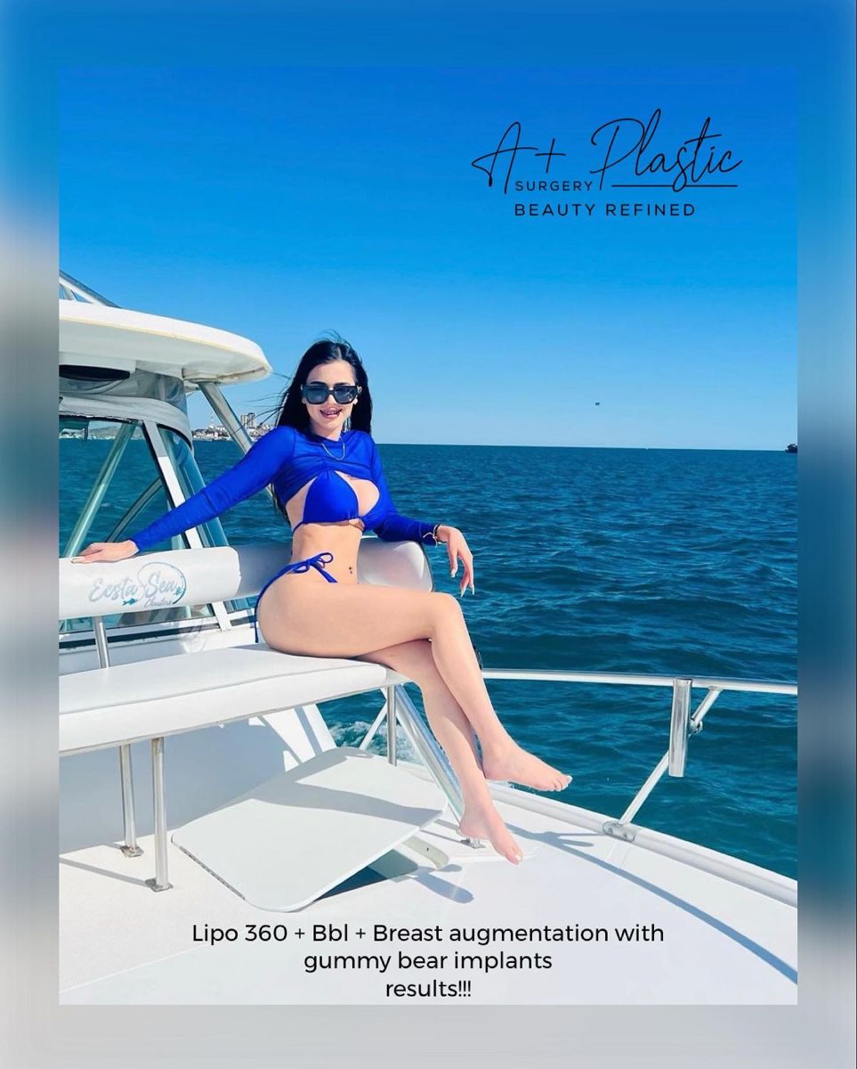 Lipo 360 + Bbl + Breast augmentation results!!!🔥🔥 Evolving for You!!! 😎.…